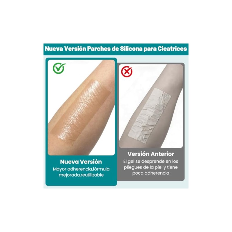 Yakiter 2M4CM Parches de Silicona para Cicatrices,Cinta para Cicatrices Recortable,Impermeable