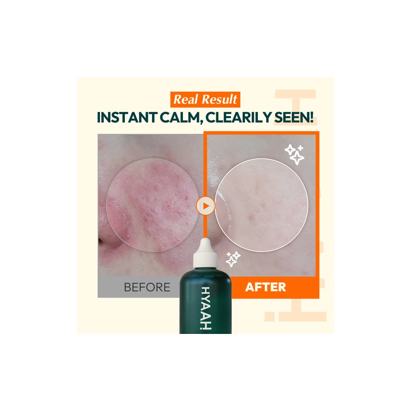 HYAAH [HYAAH]Licorice First Essence 200ml