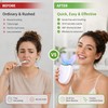 U-Shaped Electric Toothbrush for Whole-Mouth Cleaning – USB Rechargeable Sonic