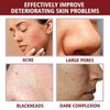 2 Bottles of AHA 30% + BHA 2% Peeling Solution,