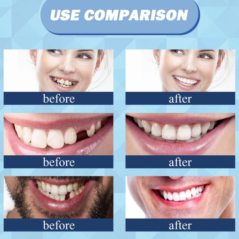 50pcs Dental Temporary Tooth Cap Crown Fake Teeth,Temporary Realistic Crown,Tooth