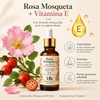 Aceite de Rosa Mosqueta 100% Puro 30 ml con Vitamina