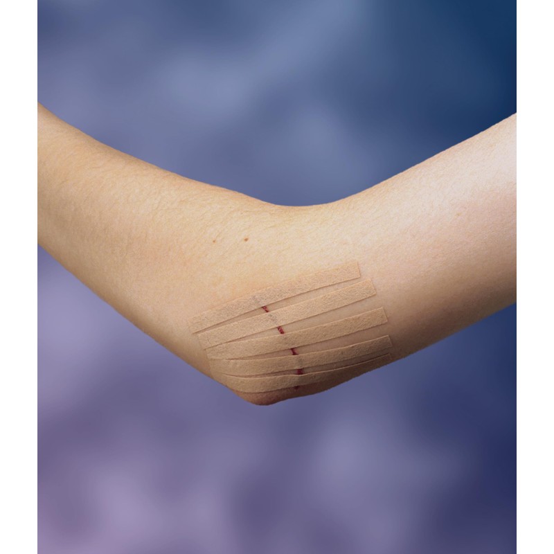 Nexcare Steri-Strip Skin Closures, Tan, 6 mm x 75 mm,