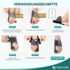TENICORE Hallux Valgus Correction with 2 Angle Irons Toe Separator