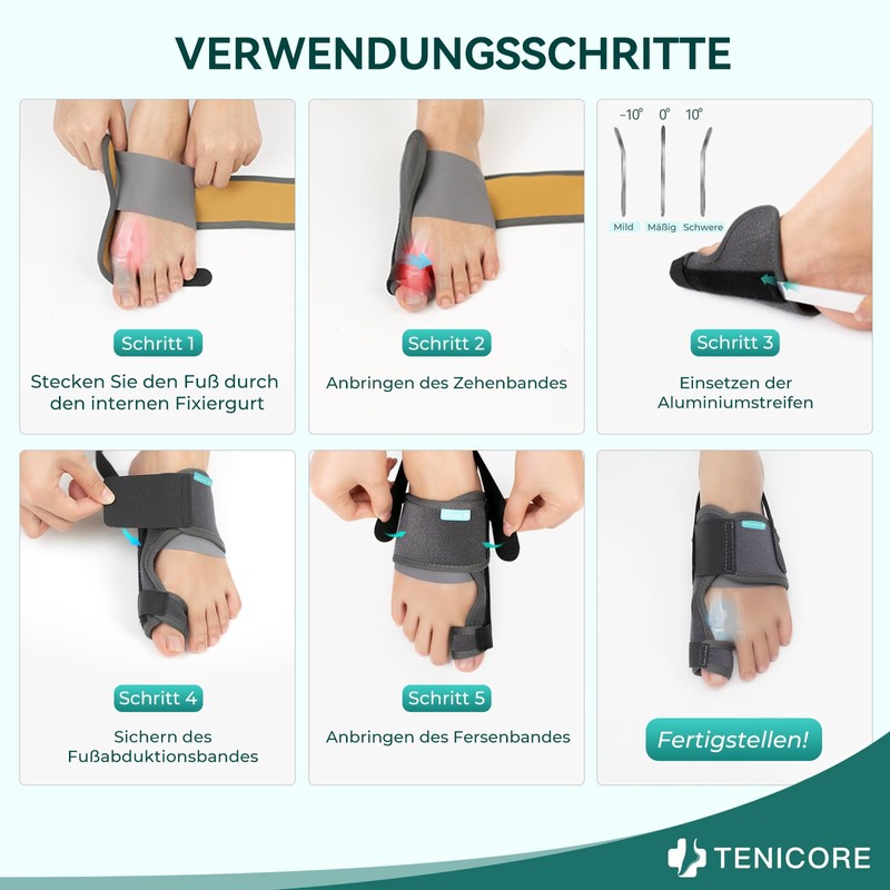 TENICORE Hallux Valgus Correction with 2 Angle Irons Toe Separator