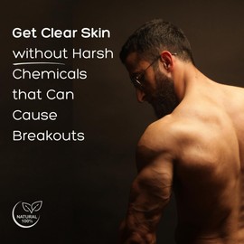 Bacne Wash: All Natural Back Acne Treatment with Charcoal, Jojoba Oil, Tea Tree Oil, Neem Oil, Aloe Vera, and Vitamin E - Body Acne Wash for All Skin Types