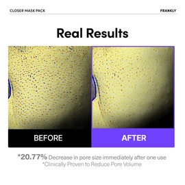 FRANKLY Closer Pore Minimizing Mask – Semi-Gel Face Sheet Mask for Pore Care & Firming | Non-sticky, Lightweight | Korean Skin Care with Collagen, Hyaluronic Acids & Peptides | 0.74 fl oz, 1pc