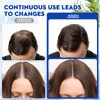 Rosemary Oil for Fuller-Looking Hair, Scalp Serum Roll On