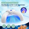 IUHFSIFS 426BWUZHID Nail Fungus Laser Device VUIYH