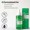 Nineless Control Azelaic Acid Serum 30ml Sérum Facial Ácido Azelaico