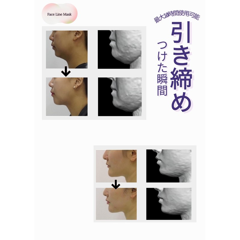 Small Face Mask, Small Face Belt, Face Liposuction Fixing Band,