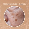 Crema Despigmentante Manchas Melasma Acné Paño Todo Tipo Piel Día