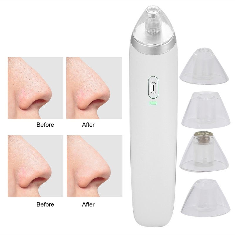 Electric 4‑In‑1 Blackhead Removal Pore Cleaner Suction USB Charging Face