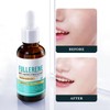 Niacinamide Whitening Serum (2 Pieces, Kangzhourunfujh)