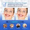 Teeth Whitening Strips, Tooth Whitening Kits, at Home Teeth whitening