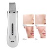 Ultrasonic Face Skin Scrubber Blackhead Removal Ion Cleaner Facial Cleanser