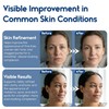 Glycolic Acid Pads - Resurfacing for Face Exfoliating for Body