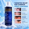 Ketoconazole 1% Anti-Dandruff Shampoo Itchy Scalp Flake Control 200ml