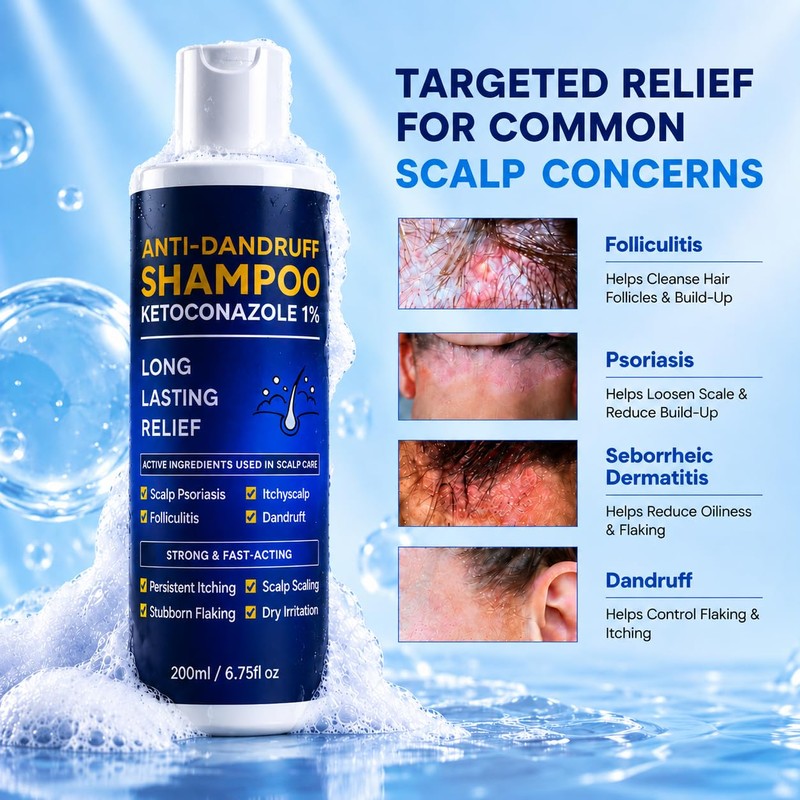 Ketoconazole 1% Anti-Dandruff Shampoo Itchy Scalp Flake Control 200ml