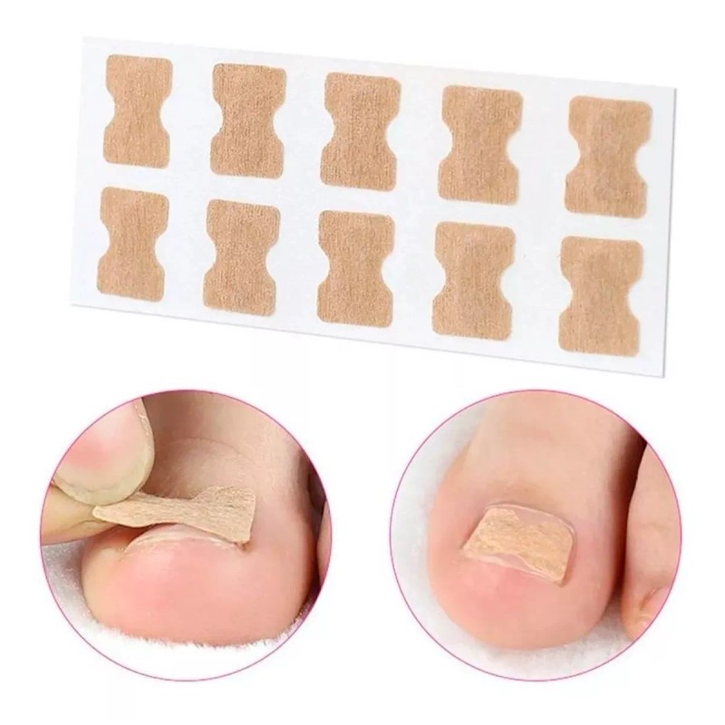 Universo en Linea 50 Parches Correctores Uñas Enterradas Uñeros Adhesivos