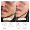 🔥 Parches antiedad de silicona skin lift reutilizables día y