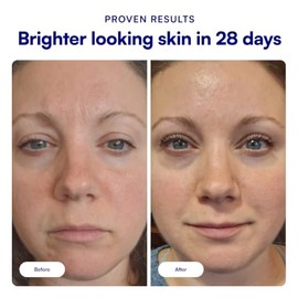 Bliss Suero iluminador para el rostro con vitamina C y colágeno tripéptido Bright Idea: antienvejecimiento, reduce las manchas oscuras, aumenta la elasticidad de la piel, limpio, vegano y sin cruel