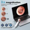 Aertnelz Otoscope Ear Camera with 1.38” Screen, 1080P HD Ear