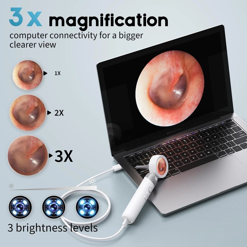 Aertnelz Otoscope Ear Camera with 1.38” Screen, 1080P HD Ear