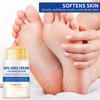 60% Urea Hydrating and Anti-Cracking Foot Cream, 2026 Upgraded Moisturising