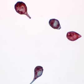 Stentor Prepared Microscope Slide, Whole-Mount