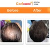 Carlxanz Hair Fiber Classic (4 x 25g)