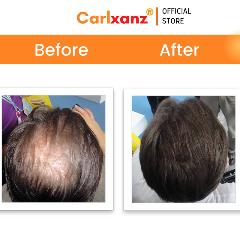 Carlxanz Hair Fiber Classic (4 x 25g)