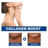 Hydrolyzed Collagen Lifting Face Neck Cream Pa Firming