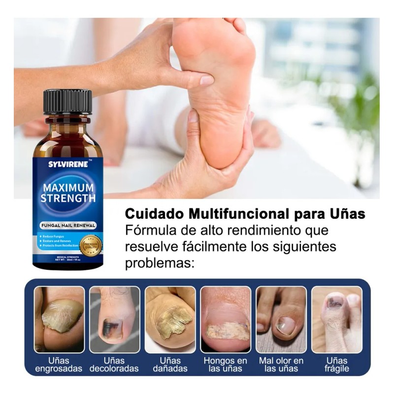 Líquido Para Hongos En Uñas - Cur-a Hongos Y Onicomicosis