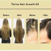E Aceite Natural Para El Crecimiento Del Cabello,suero Y
