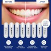 Mr.Whitener Teeth Whitening Refill Kit – 8 Gel Pods (33.6ml)