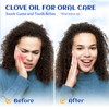 HIQILI 100ML Clove Oil for Teeth and Gums, Tooth Aches,