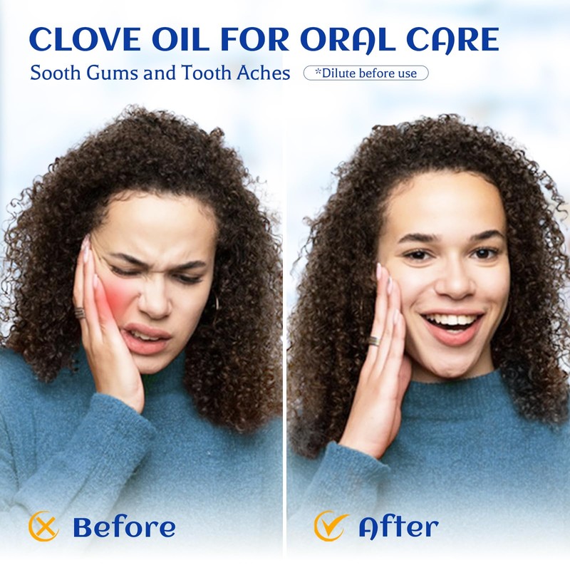 HIQILI 100ML Clove Oil for Teeth and Gums, Tooth Aches,
