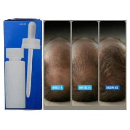 Tratamiento Capilar, Restauración | Serum Fuerza Anti-caida 360ml | Ayuda al Crecimiento, Densidad y Fortalecimiento de
