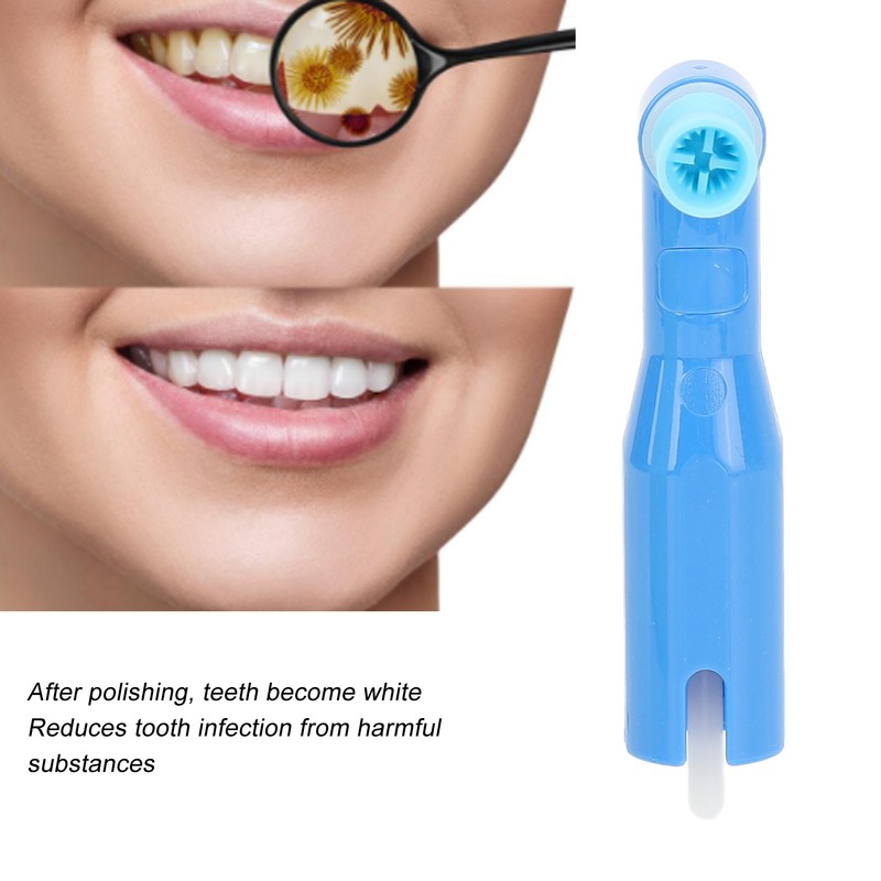 100pcs Oral Polishing Cup Kits Teeth Stains Removal Disposable Polisher