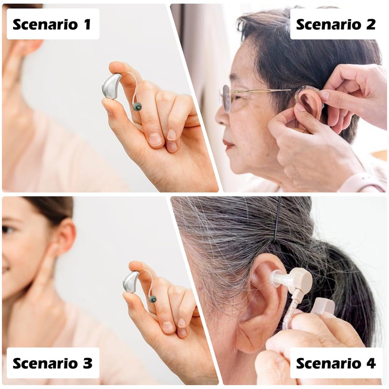 Hearing Aid Domes for Oticon Replacement: Hearing Aid Domes Oticon