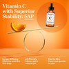 TruSkin Vitamin C Serum – Anti-Aging Facial Serum with Vitamin