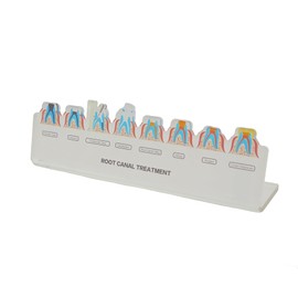 Dental Model Teaching Model Root Canal Treatment Flowchart Stand Visual Guide for Endodontic Procedures Educational Tool Dentists Lab Students Gift (M4036)
