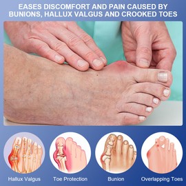 ACWOO Bunion Corrector for Women and Men, Big Bunion Corrector Set with 2 x Orthopedic Bunion Splints and 2 x Big Toe Straighteners, Adjustable Hallux Valgus Correction for Day/Night Support