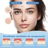 Parches para Acne,Pimple Patch,200 Almohadillas Hidrocoloides para Espinillas, Parches para