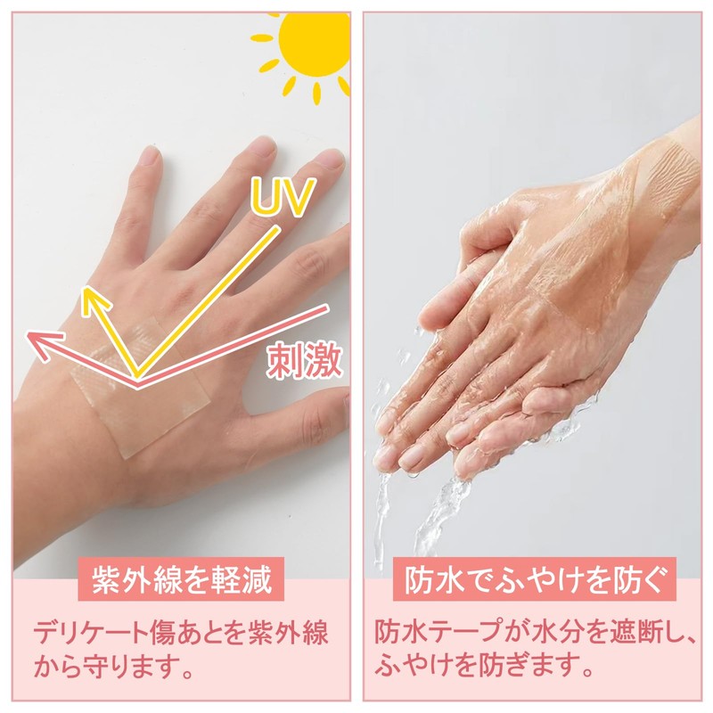 傷跡ケアテープ ケロイド テープ 傷あとケア用シリコンジェルシート 手術後 帝王切開 傷テープ 傷隠しテープ