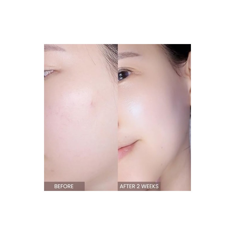 [APLIN](アプリン)ピンクティーツリートナー 150ml Pink teatree toner 化粧水 拭き取り化粧水 水分保湿 敏感肌 脂性肌