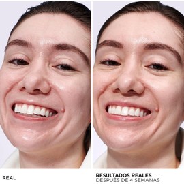 It Cosmetics Confidence in a Gel Oil Control Cream, Gel Hidratante Facial, Reduce el Brillo y la Apariencia de Poros Grandes con Niacinamida, Vitamina E y Péptidos, 60 ml