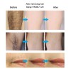 50ml Inhibidor Del Crecimiento Del Cabello Barba Permanente