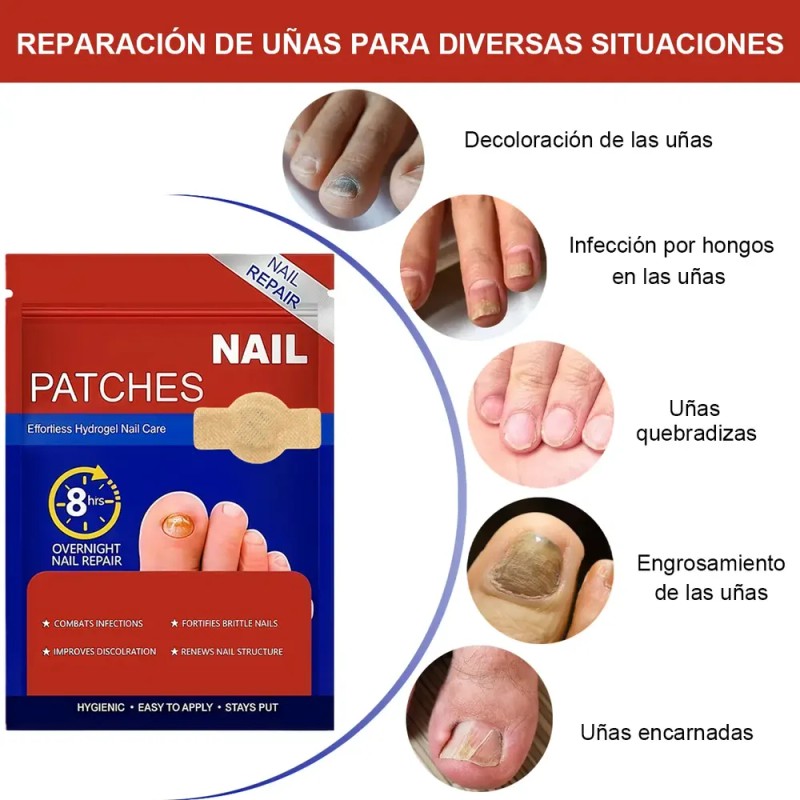 & [100 Parches Antimicóticos Para El Tratamiento De Hongos E